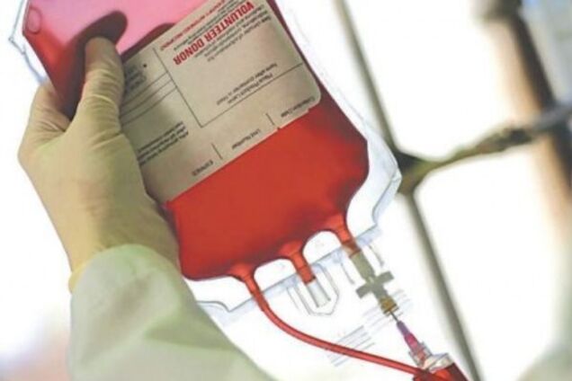 Играла со спичками: первоклассница из Киева получила ожоги 40% тела