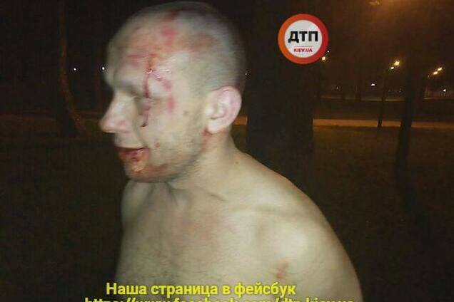 Взрыв в Киеве из-за пьяного АТОшника разделил украинцев