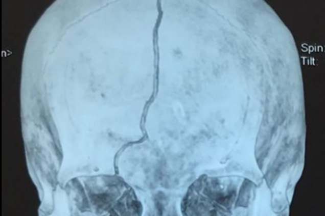 В коме: в Одессе проломили голову бабушке основателя радиостанции