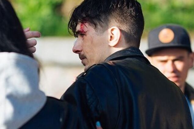 'Я жив': стало известно об инциденте с солистом 'Время и Стекло'