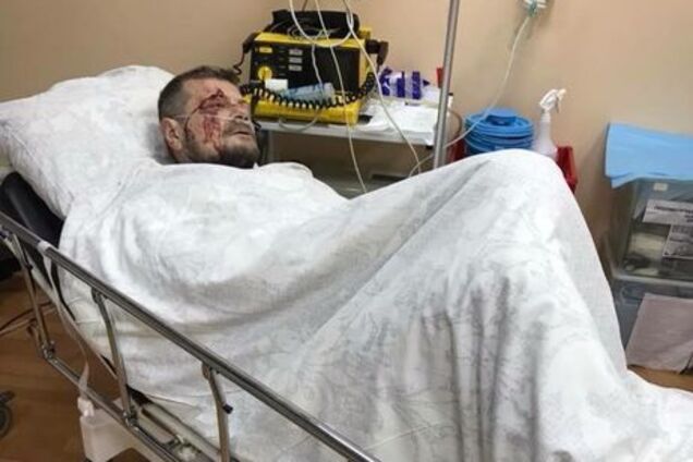 Теракт раскрыт: в СБУ отчитались о покушении на Мосийчука