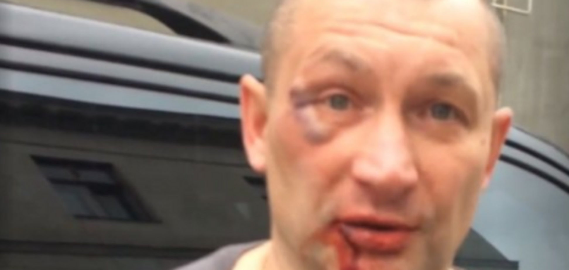 Патриота Украины в Крыму жестоко избил 'ночной волк'. Опубликованы фото