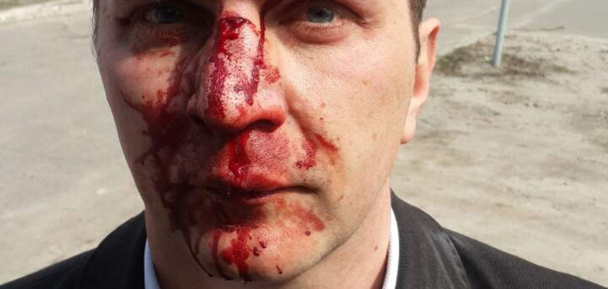 Избили врача