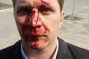 Избили врача