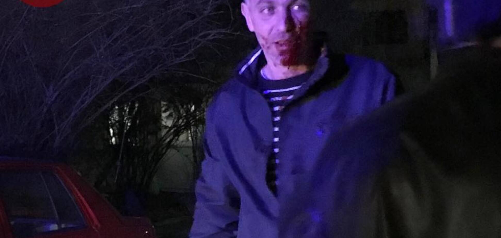 Киевляне устроили поножовщину у всех на виду