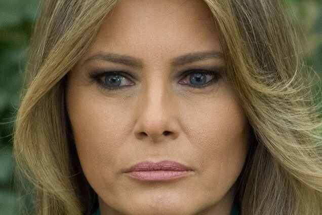 Найдена опухоль: Мелания Трамп госпитализирована