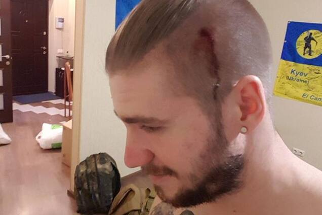 В голове дырка: в Киеве напали на секс-символ АТО