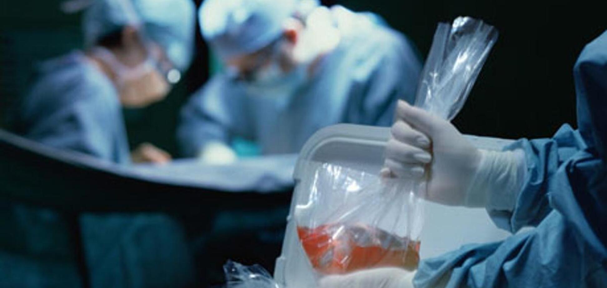 Трансплантация органов в Украине: эксперты развеяли популярные страшилки