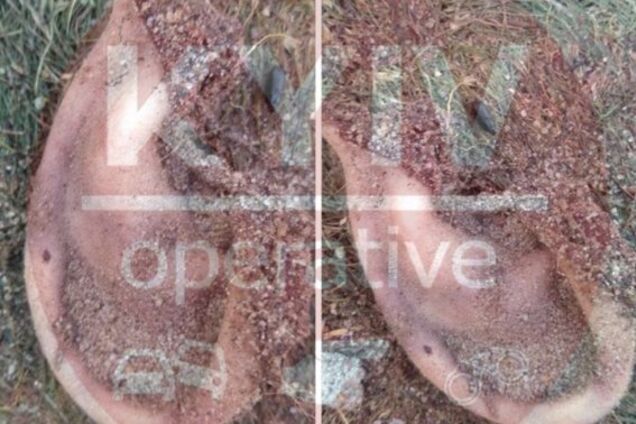 Напились и оторвали ухо: в Киеве произошла жуткая драка