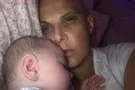 "Врос в матку": женщину едва не убил ее нерожденный ребенок