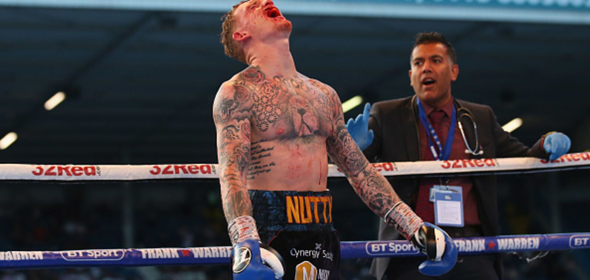 Британського боксера понівечили в титульному бою: фото не для людей зі слабкими нервами