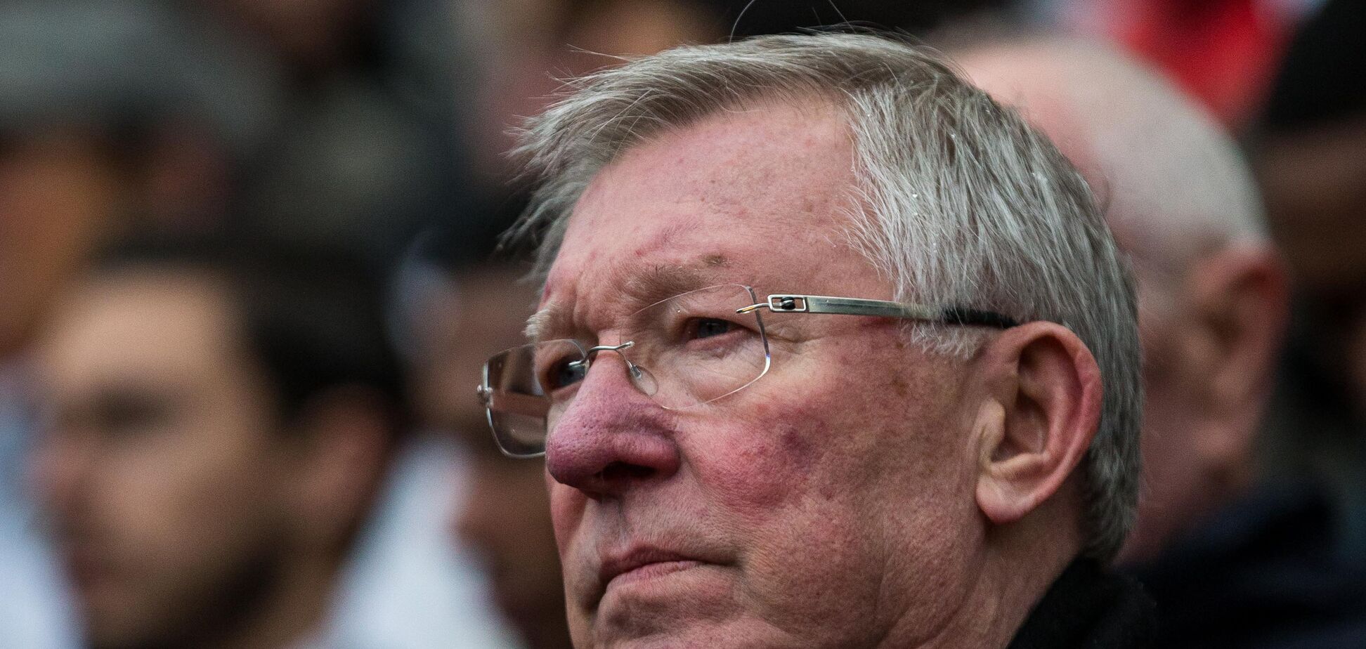 Алекс Фергюсон госпіталізований у важкому стані: названа причина