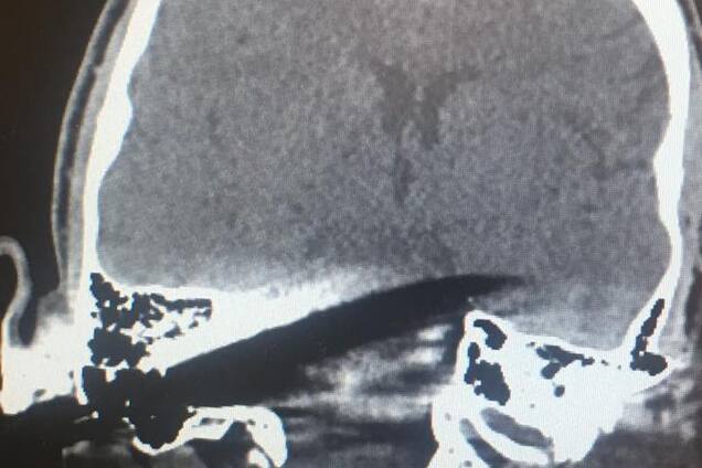 Сделал замечание: в Киеве мужчине воткнули нож в голову