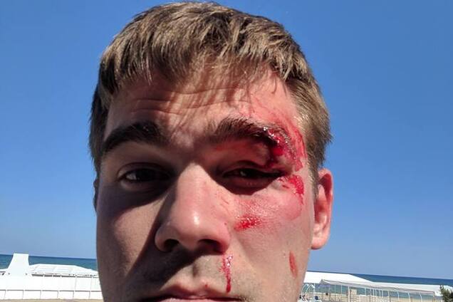 'Будеш мене вчити': власник київського магазину жорстко побив покупця