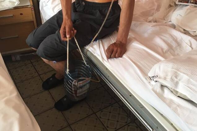 Пытали и два года держали в сарае: в Украине воспитанник интерната попал в рабство