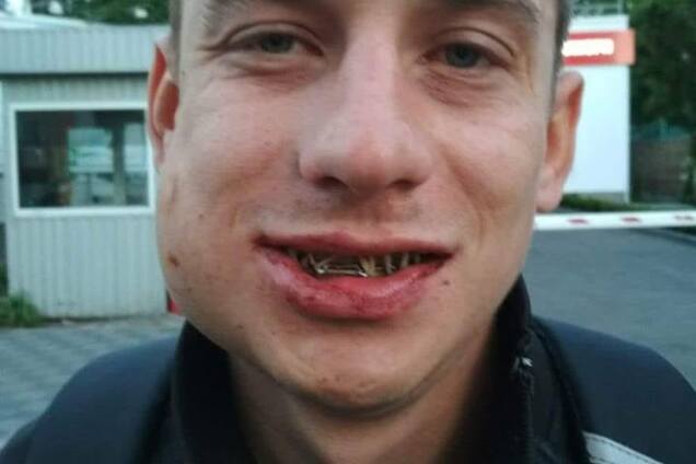 'Охорона ніяк не допомогла': у Києві у відомому супермаркеті побили чоловіка