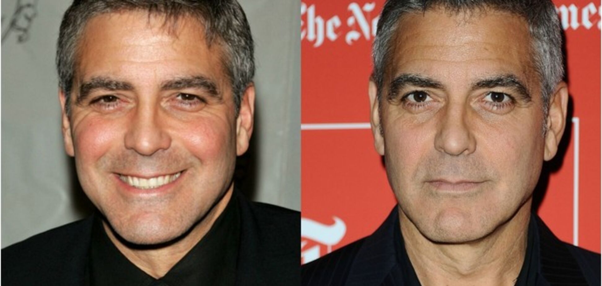 Под нож: зачем мужчины делают пластические операции