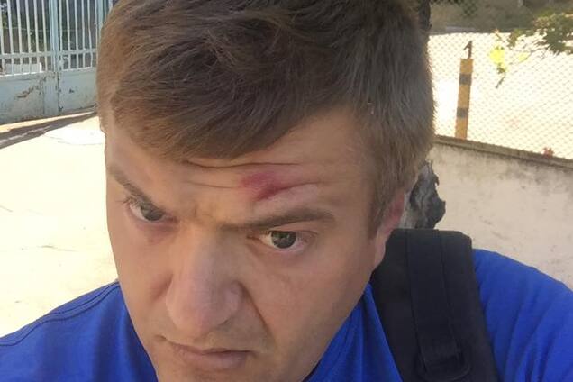 'Били сильно': в Херсоне напали на известного журналиста