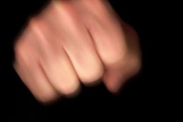 В Мариуполе военному сломали челюсть за украинский язык