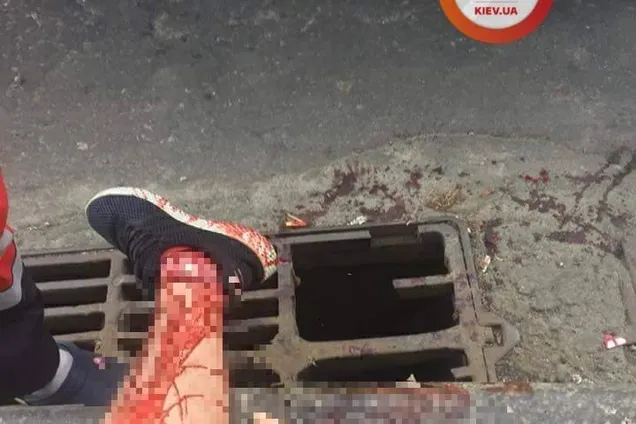 "Дев'ять швів і урок на все життя": у Києві посеред вулиці сталася надзвичайна подія