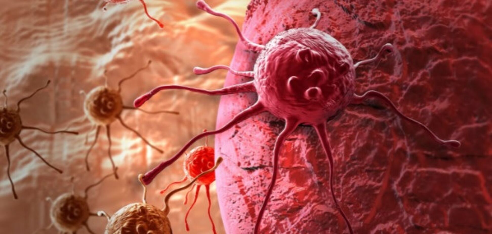 Вчені назвали хворобу-'індікатор' раку