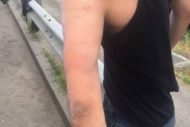 Все тело в побоях: появились подробности похищения сына ливийского дипломата