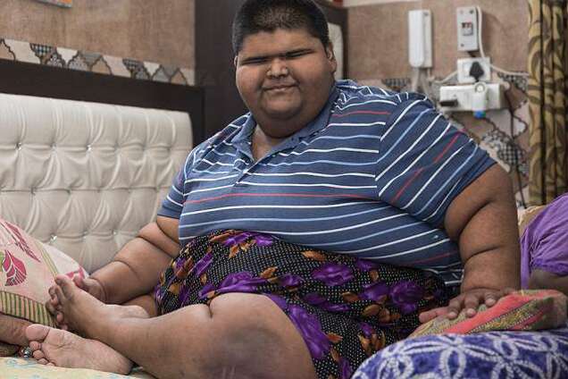 Самый толстый ребенок в мире похудел: удивительные фото и видео