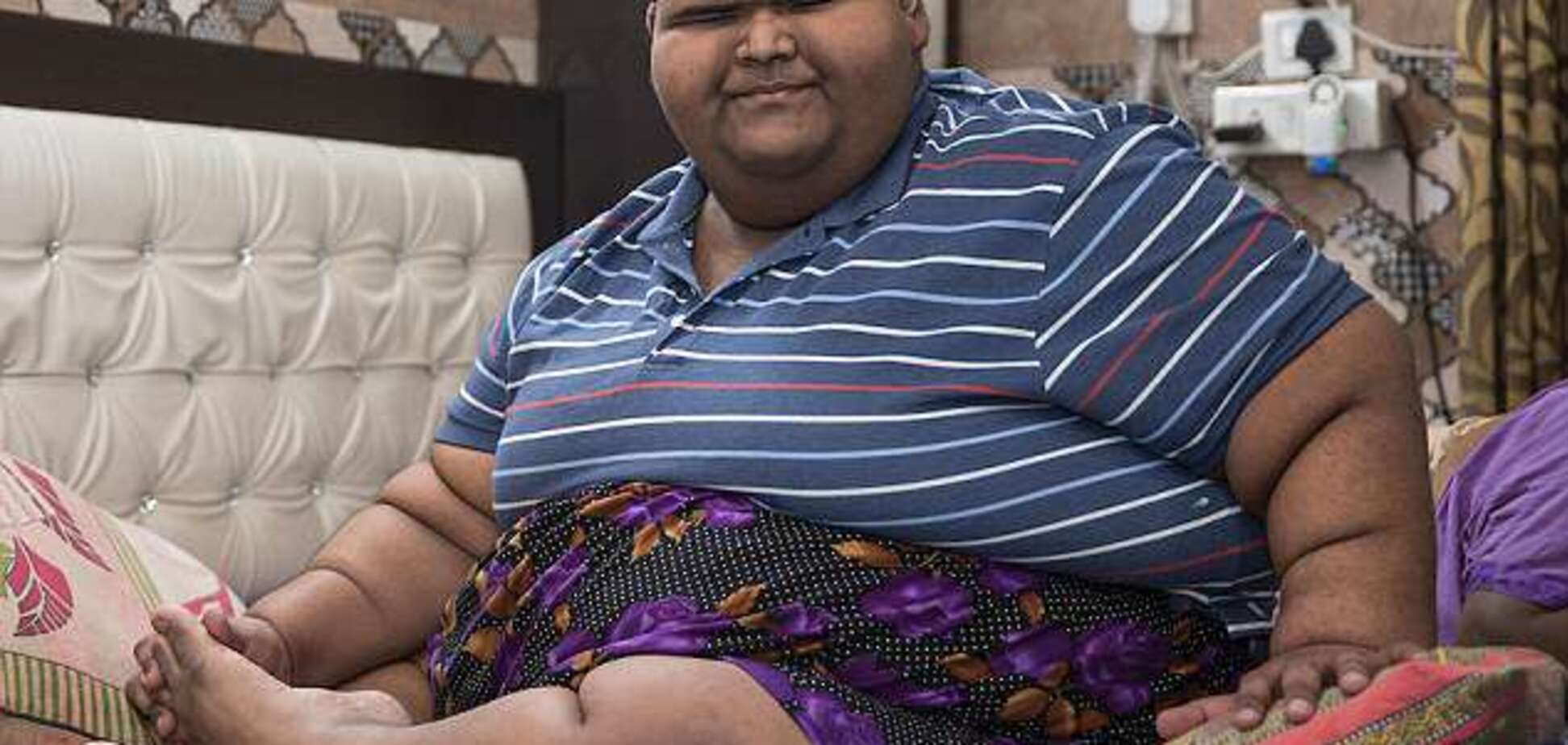 Найтовстіша дитина в світі схудла: дивовижні фото і відео