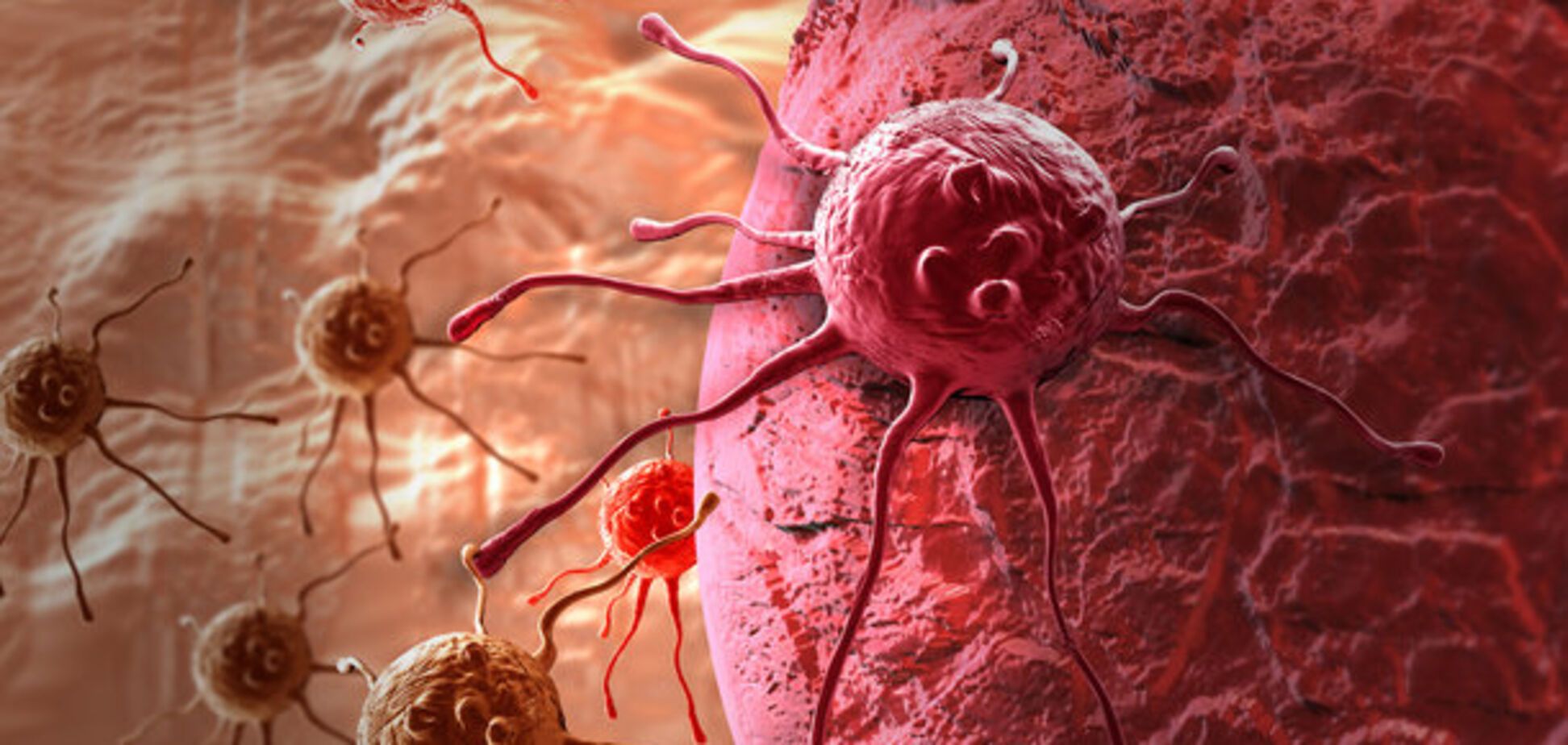 Ученые нашли способ вылечить рак в последней стадии