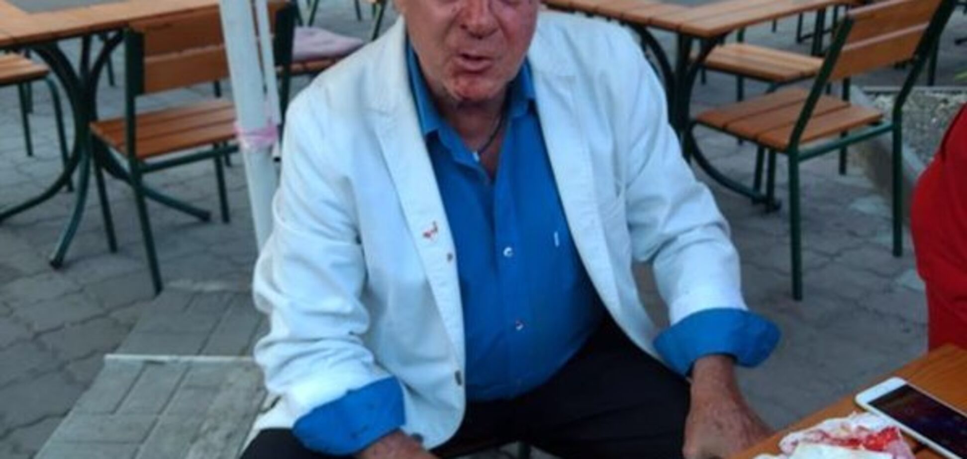 Избиение ученика Френка Синатры в Одессе: полиция нашла виновника