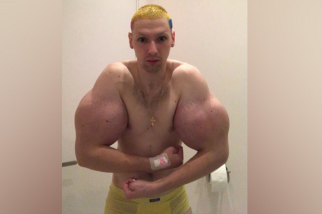 Руки-базуки