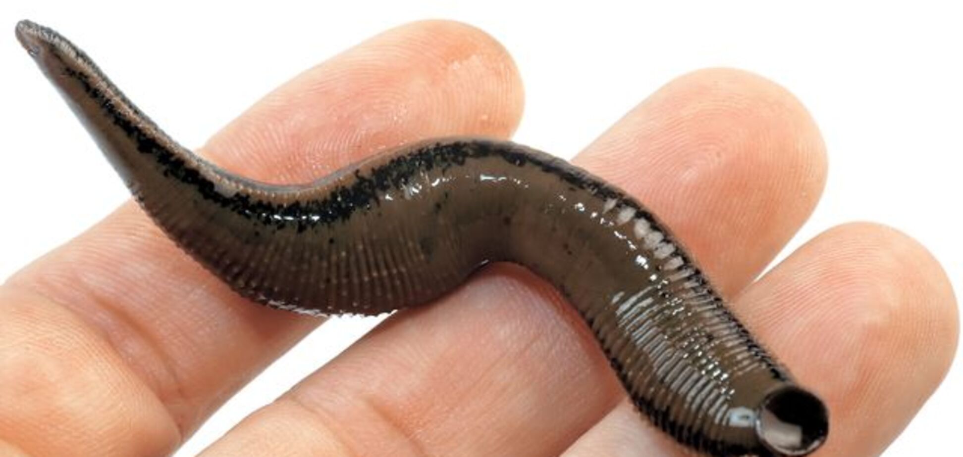 Криваве пекло: мережу налякав вигляд п'явки, яка втікає з лікарні