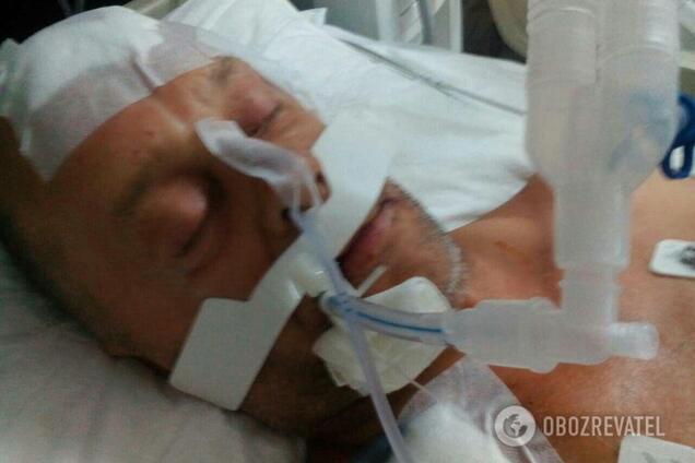 Умер зверски избитый россиянином в Турции украинец