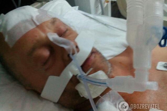 Россиянин до смерти избил украинца в Турции: появились новые подробности