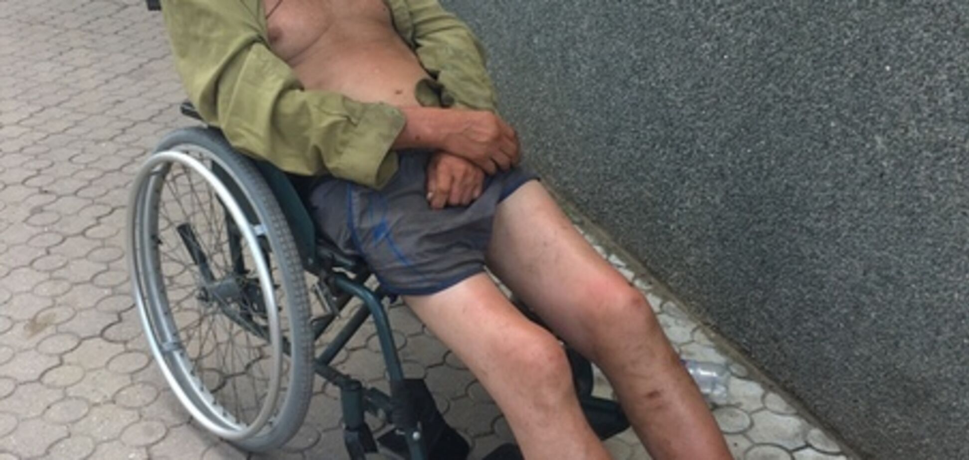 В оккупированном Крыму заживо гниют бомжи: опубликованы жуткие кадры