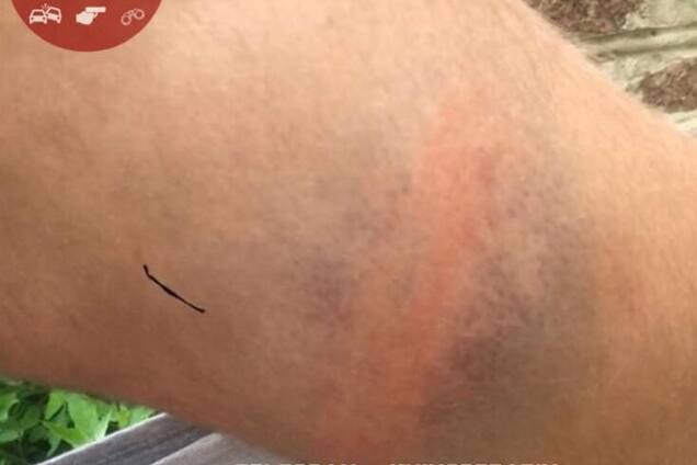 В Киеве ромы жестоко избили прохожего: опубликованы фото