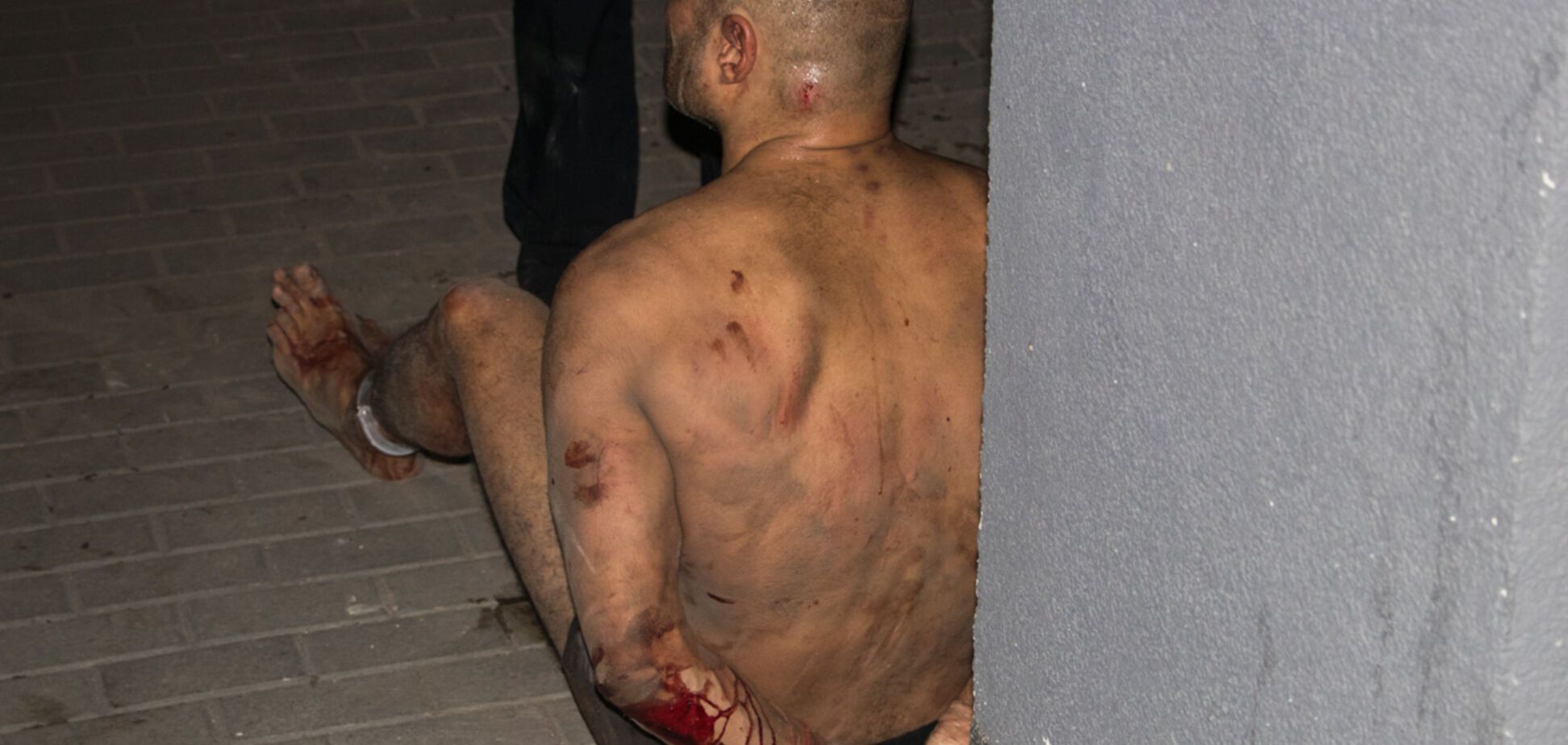 Окровавленный мужчина в трусах напугал жителей Киева