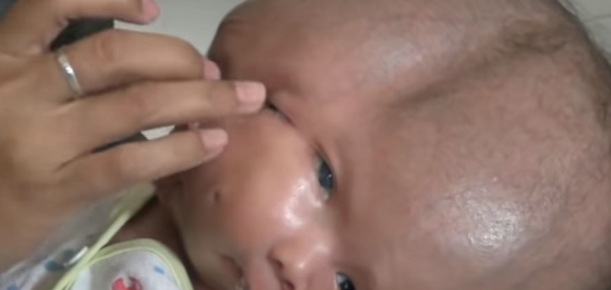 'Поглинув' свого брата: в Індонезії народився хлопчик із двома обличчями і парою мізків. Моторошні фото і відео