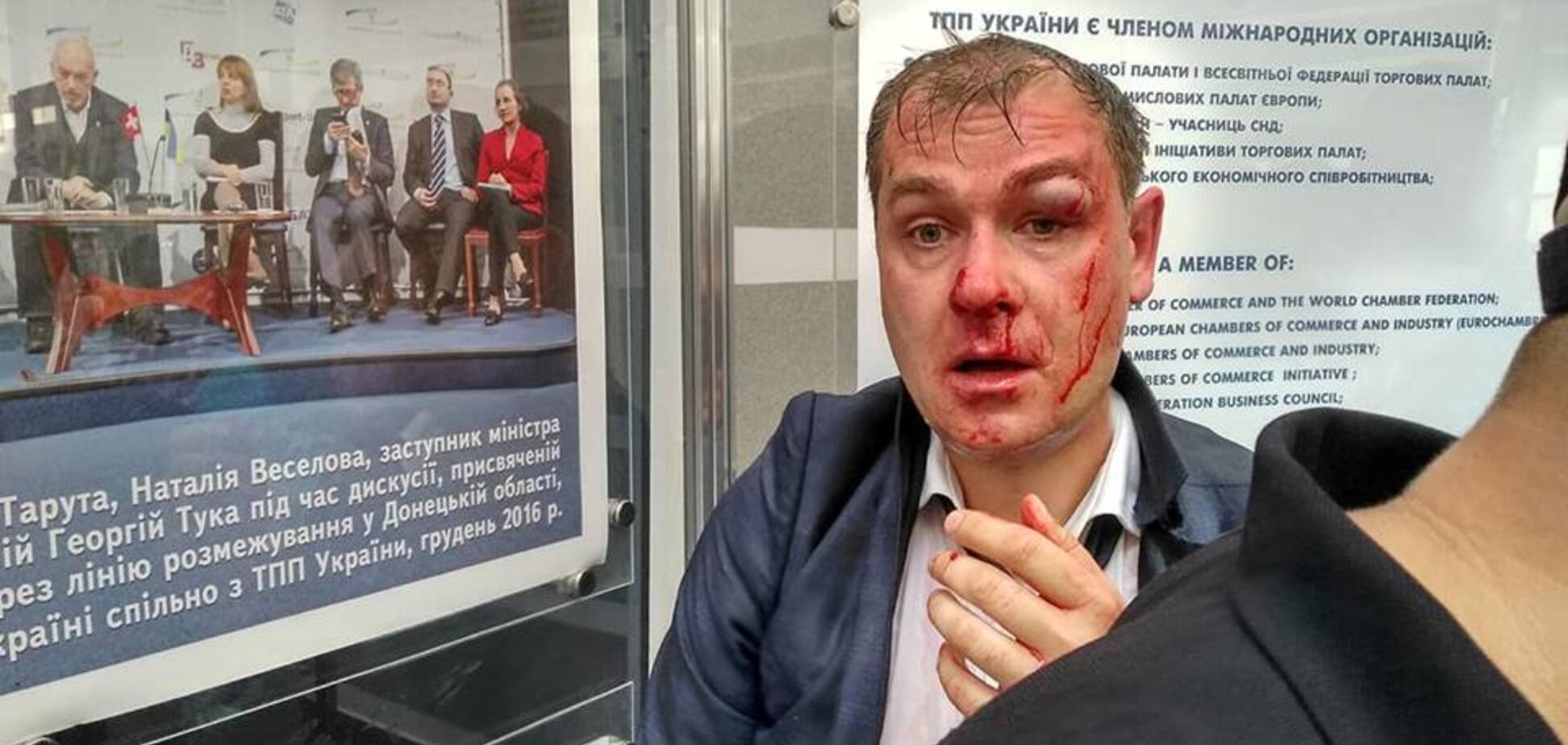 'У меня сотрясение!' Избитый в Киеве политик рассказал свою версию ЧП 