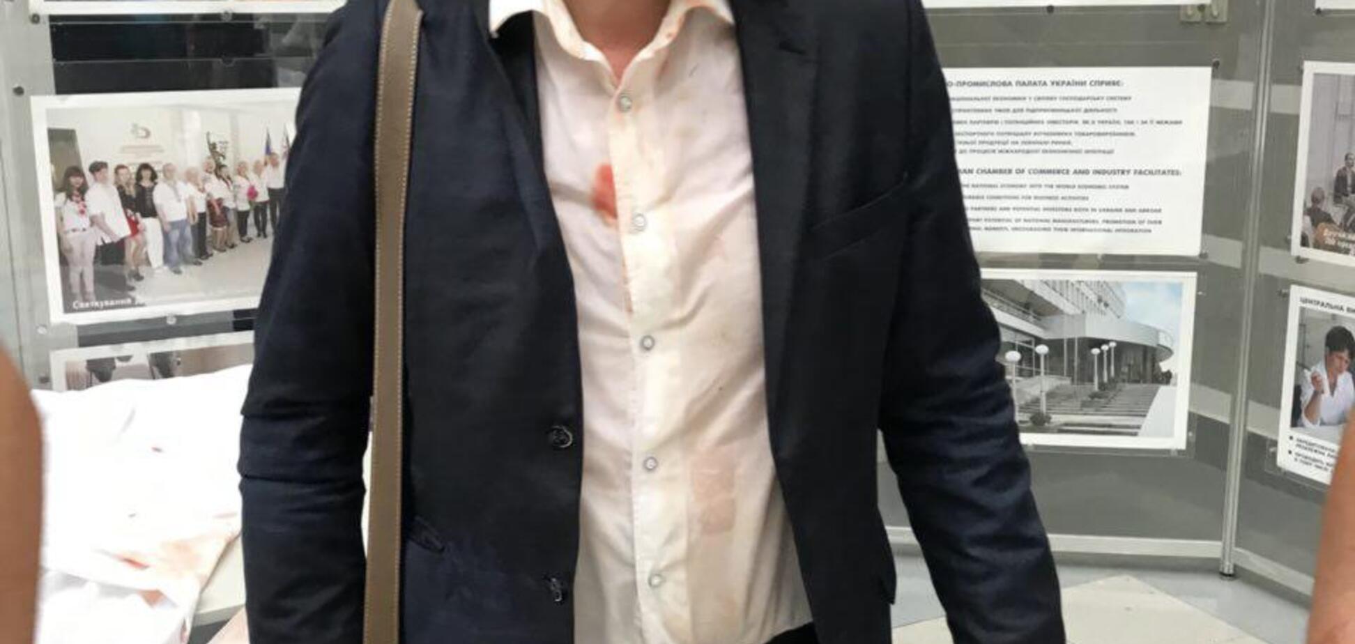 Влада руками націоналістів знищує нові партії - Розумна сила