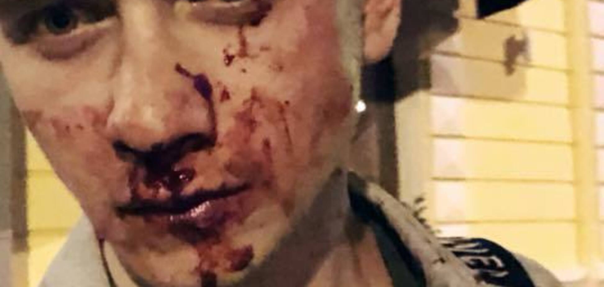 Побитий у Києві блогер із Росії заговорив українською