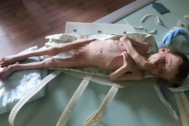 'Это эксперимент': отец заморенного голодом ребенка сделал скандальное заявление