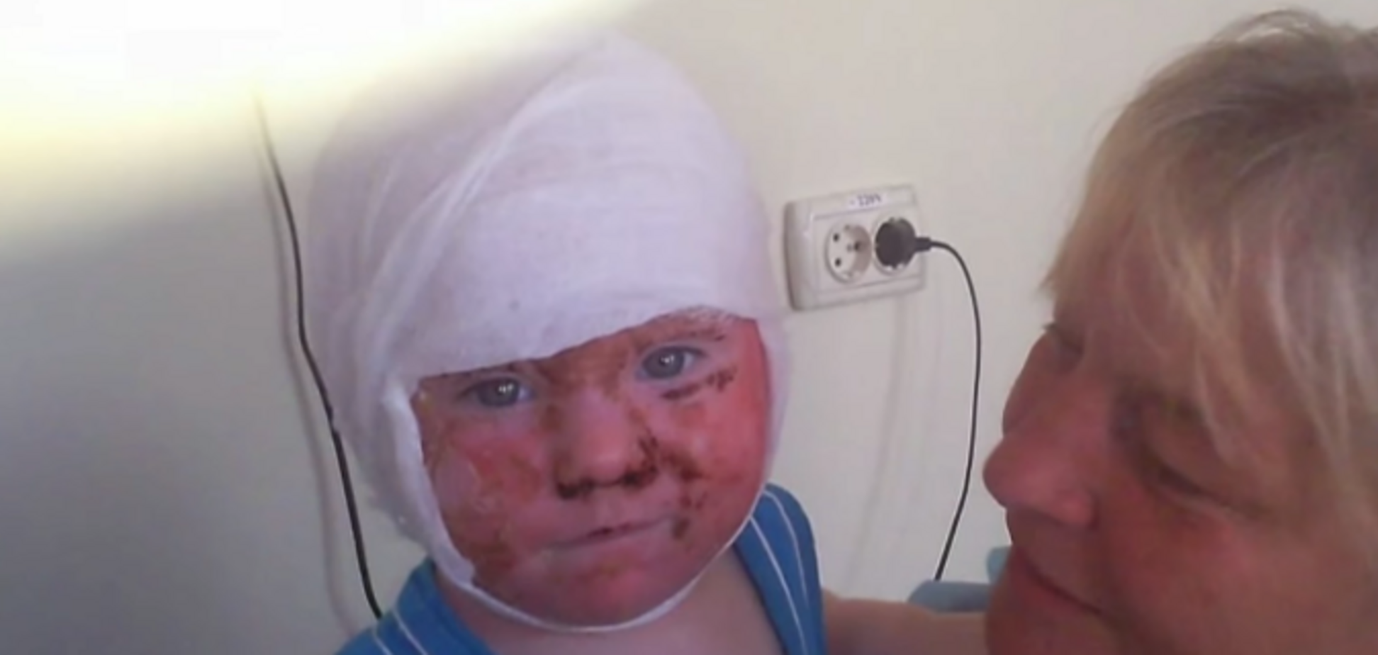 Облили малыша кипятком: детдом угодил в скандал из-за возмутительного ЧП