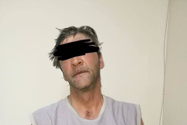 'Раны по всему телу': почему одессит облил ребенка кислотой