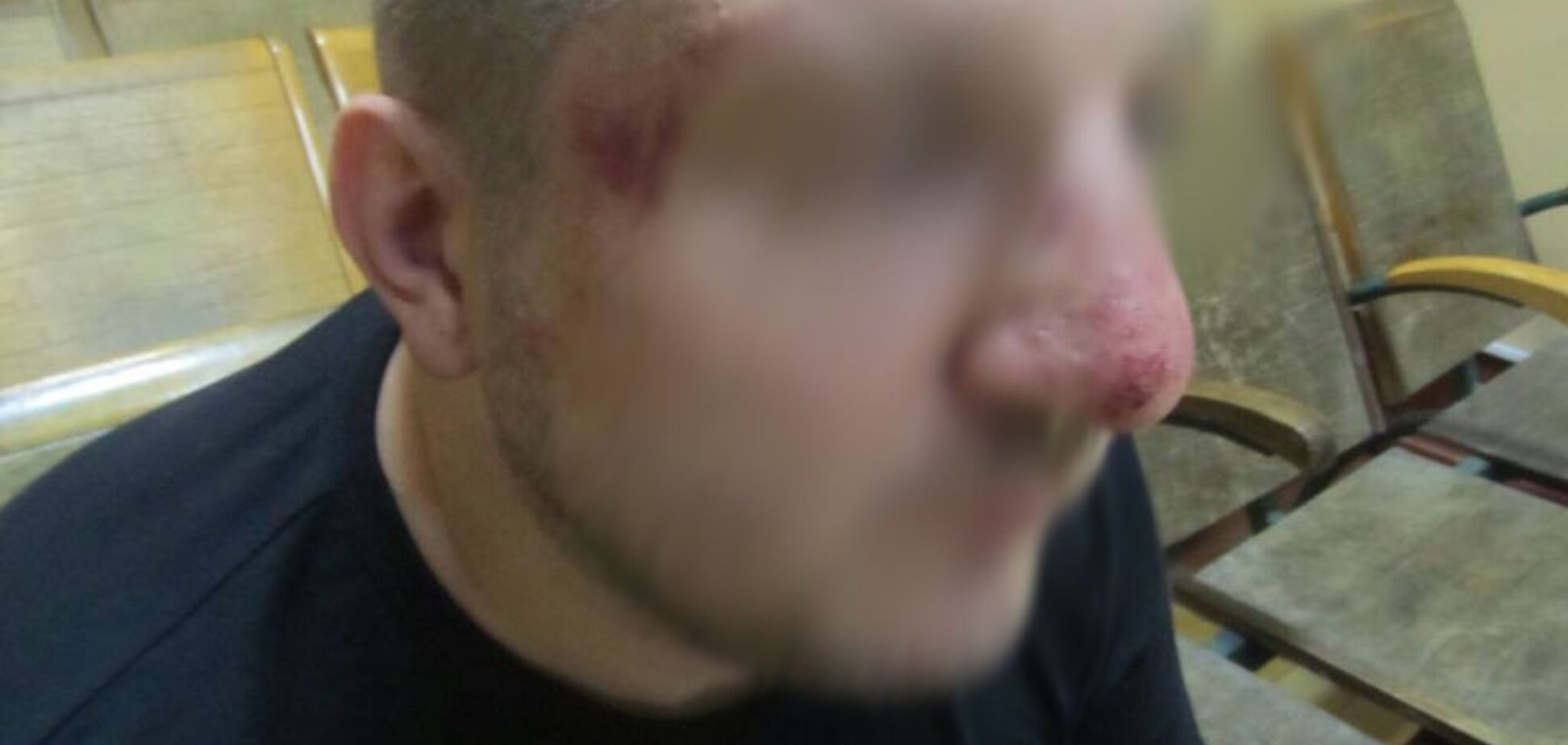 Российские пограничники жестоко избили украинца: появились фото и видео