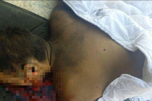 У Сумах застрелили екс-чиновника: перші криваві фото з місця вбивства, 18+