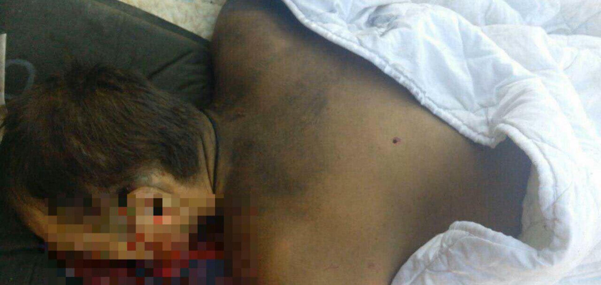 У Сумах застрелили екс-чиновника: перші криваві фото з місця вбивства, 18+