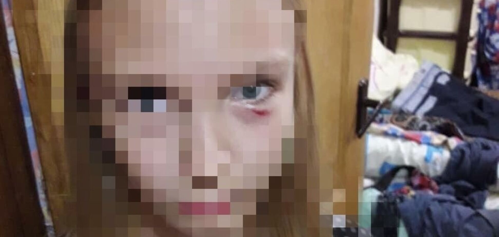 Била по голове и почкам: в Киеве женщина накинулась на ребенка