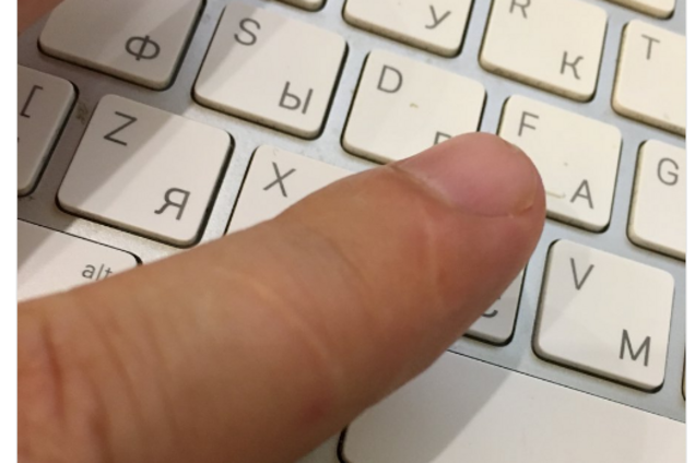 'Метка рептилоида?' Мужчины обнаружили 'мистический' знак на теле и массово делятся феноменом в сети