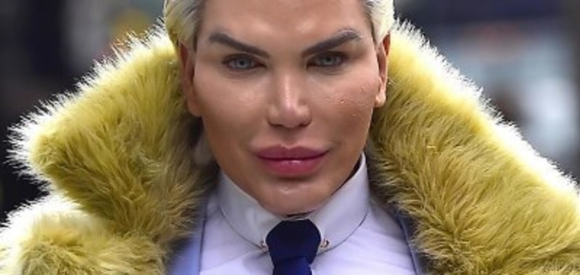 58 операций: журналисты выяснили жуткие факты о мужчине-кукле из Бразилии